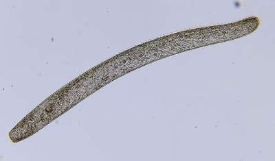 Простейшее Spirostomum ambiguum под микроскопом. Фото: Wikipedia