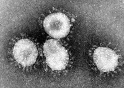 В отличие от вируса гриппа, новый коронавирус не даёт клетке синтезировать белки интерфероны, которые ограничили бы инфекцию и привлекли бы к вирусу внимание иммунитета. Фото: CDC / Dr. Fred Murphy / Wikipedia
