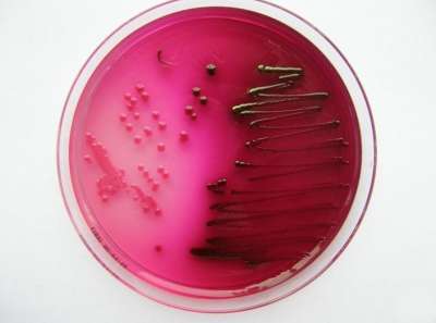 Чашка Петри с бактериями Escherichia coli. Фото: Wikimedia Commons
