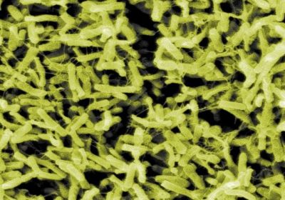 Микрофотография бактерий рода Clostridium. Фото: Wikimedia Commons.