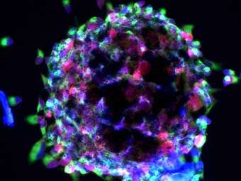 Стволовые клетки. Фото с сайта rsna.org