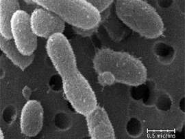 Электронная фотография бактерий Chryseobacterium greenlandensis. Фото авторов исследования.