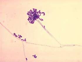 Aspergillus fumigatus под микроскопом. Фото пользователя Patho с сайта wikipedia.org