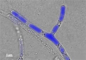 На картинке представлена микрофотография гифа в процессе транспортировки им фенантрена, полученная при флюоресцентной микроскопии. Фенантренсодержащие пузырьки окрашены в синий цвет. 