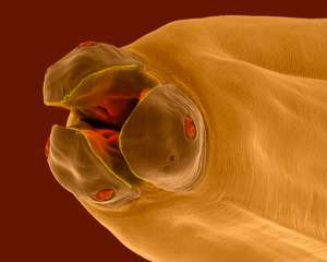 Toxocara canis крупным планом (фото Dennis Kunkel Microscopy).