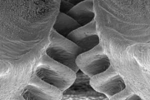  Сустав кузнечика под микроскопом. Фото: Malcolm Burrows