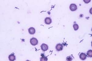 Propionibacterium acnes. Фото: http://skinfine.ru