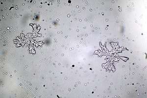 Клетки микроглии (фото Deborah (polarcollision)).