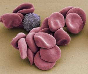 Эритроциты и белая кровяная клетка под электронным микроскопом. (Фото Dr. Thomas Deerinck / Visuals Unlimited / Corbis.) 