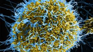   Изображение, полученное сканирующем электронным микроскопом и раскрашенное с помощью цифровых технологий. Голубым цветом отмечены нитевидные частицы вируса Эбола (иллюстрация Centers for Disease Control and Prevention).