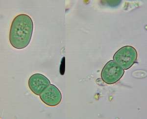 Цианобактерии рода Synechococcus. Фото yundaga / www.flickr.com/photos/98524386@N00/6939312881.