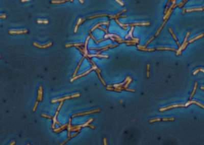 Молочнокислые бактерии / Lactobacillus acidophilus  archive of Josef Reischig