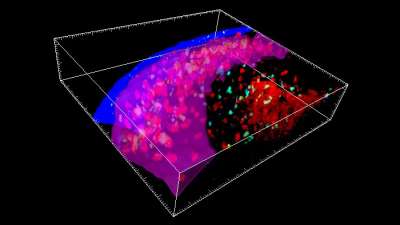 Иммунные клетки собираются в СПО, фиолетовая полоса показывает поверхность СПО. Imogen Moran/Tri Phan