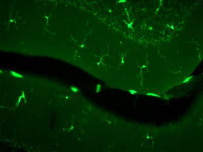 При избыточном весе иммунные клетки мозга лишают нейроны возможности сформировать новые нейронные цепочки.