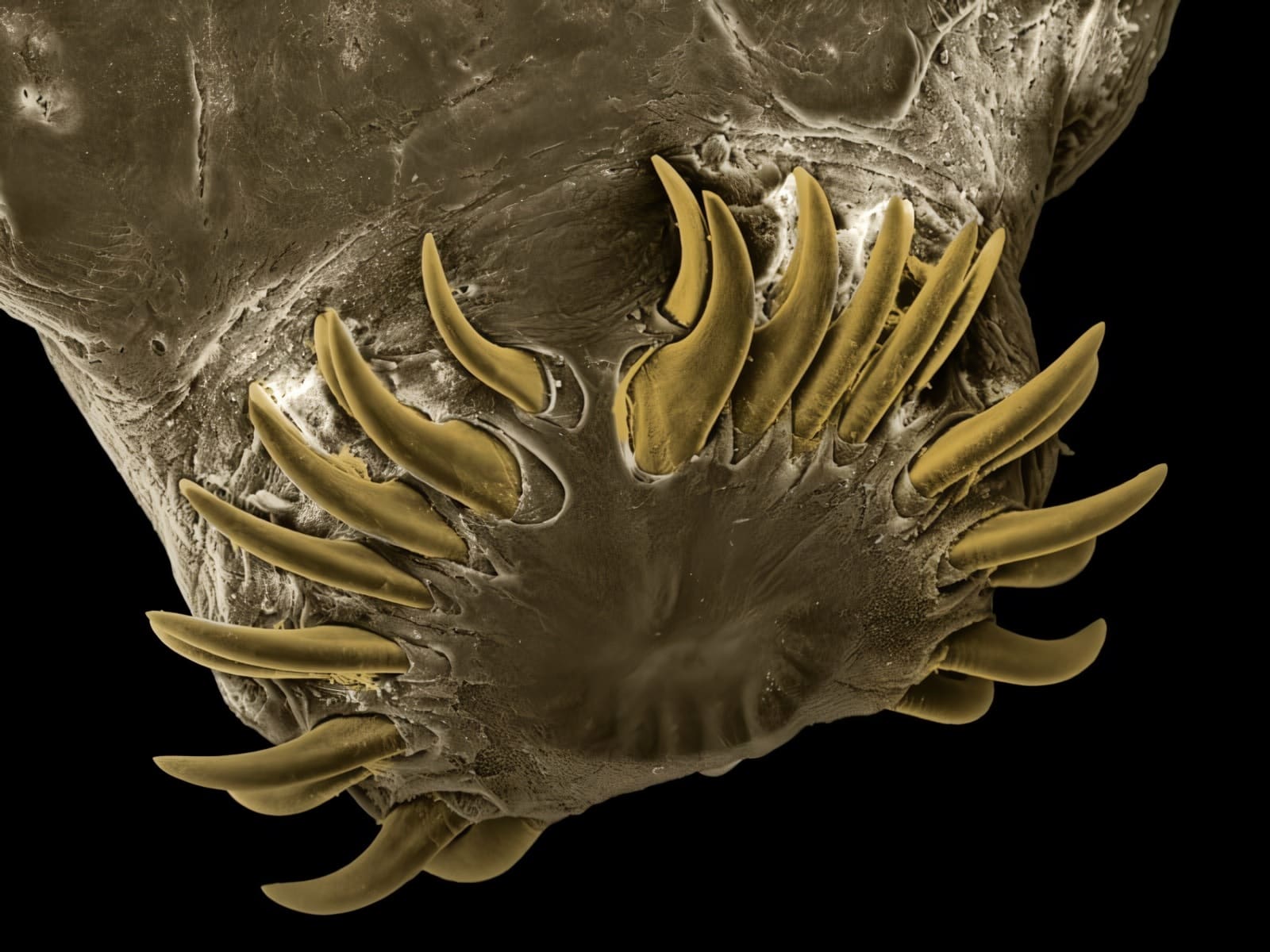 Tapeworm scolex.