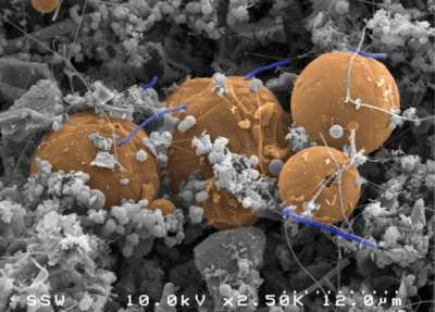 Бактерии Desulforudis audaxviator (палочкообразные клетки лилового цвета) выживает в водороде. Они были найдены на глубине 2,8 километров в золотоносной шахте Мпоненг в Южной Африке. Greg Wanger / California Institute of Technology, USA и Gordon Southam University of Queensland, Australia