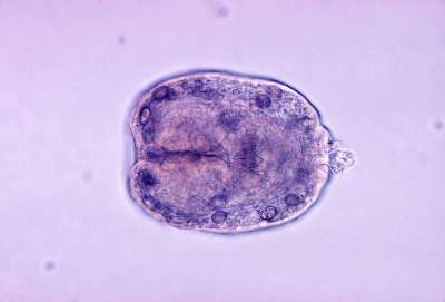 Echinococcus granulosus. Фото wikipedia