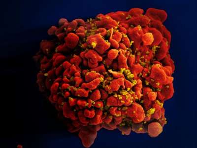 Антибиотик конканамицин А подавляет работу белка, который помогает вирусу скрываться от иммунной системы. Частицы ВИЧ на поверхности иммунной клетки. Фото: NIAID / Flickr.com