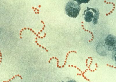 Streptococcus pyogenes под микроскопом. Фото: Public domain