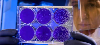 Ученые в срочном порядке проводят ряд дополнительных эпидемиологических исследований коронавируса. Фото: СДС