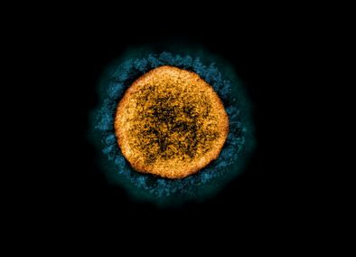 Новый коронавирус SARS-CoV-2 под электронным микроскопом. Фото: NIAID / Flickr.com