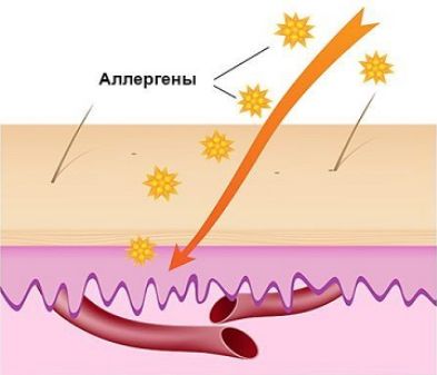 Ультрафиолет попадает не только на кожу, но и проникает во внутрь. Иллюстрация agsvv.ru.