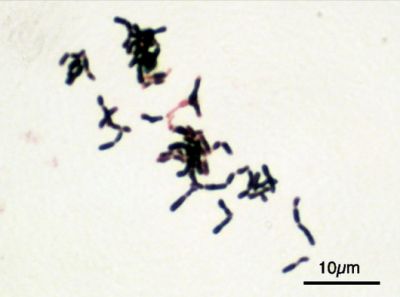 Бактерии рода Bifidobacterium. Фото: Y tambe / Wikipedia