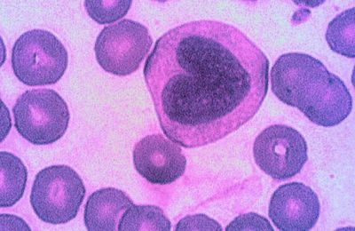 Моноцит в световом микроскопе (крупная клетка в центре). Моноциты одними из первых обнаруживают инфекцию и стимулируют защитное воспаление. Иллюстрация: Magdalena Wiklund / Flickr.com