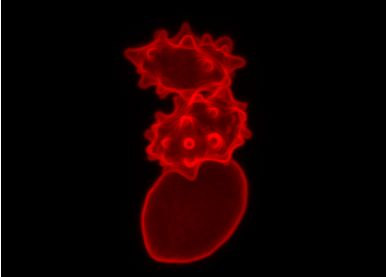Ловя митохондриальную ДНК погибших клеток, эритроциты покрываются буграми и выступами. Иллюстрация: L. K. M. Lam et. al., Science Translational Medicine, 2021