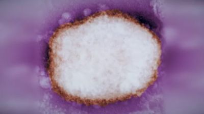 Вирус оспы обезьян под электронным микроскопом. Архивное фото CDC.