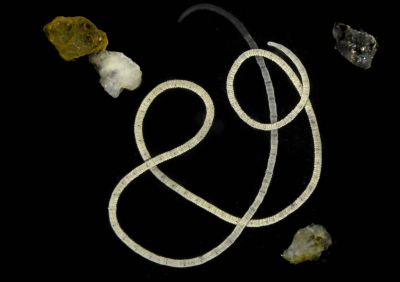 Эти миниатюрные черви смогли изменить наши представления о биохимии живых организмов.  Фото: Rebekka Jahnke/Max Planck Institute for Marine Microbiology.