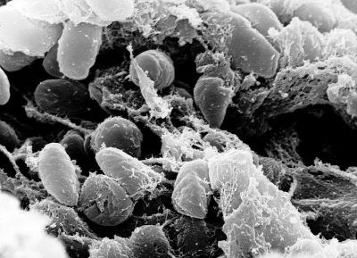 Yersinia pestis, электронная микрофотография Wikipedia.