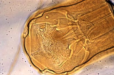 Голова паразитического червя Necator americanus. Фото: CDC / Dr. Mae Melvin.