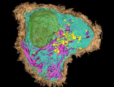 Дендритная клетка (3D-реконструкция, сделанная с помощью разновидности электронной сканирующей микроскопии). Иллюстрация: ZEISS Microscopy / Flickr.com.