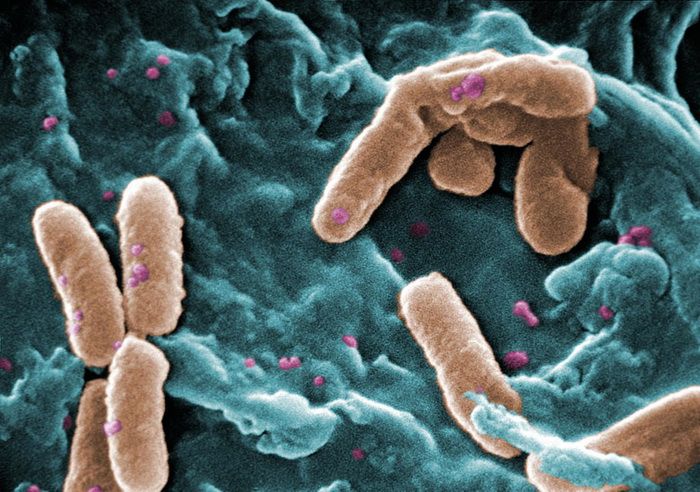 Синегнойная палочка Pseudomonas aeruginosa, электронная микрофотография. Фото: CDC / Janice Haney Carr / Wikipedia