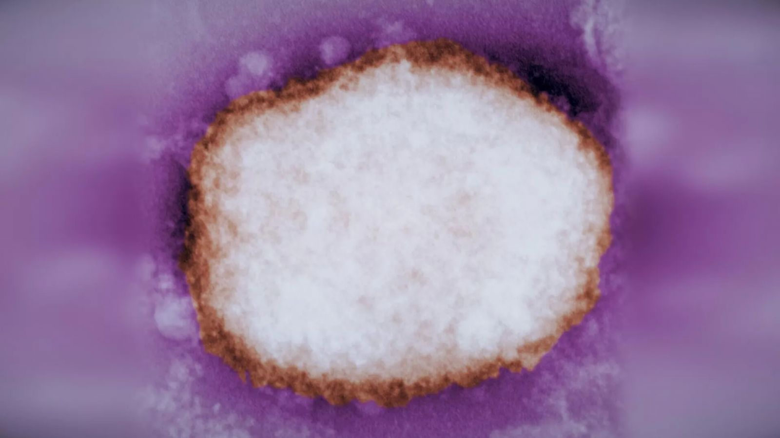 Вирус оспы обезьян под электронным микроскопом. Архивное фото: CDC
