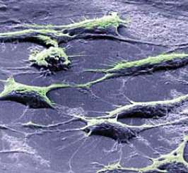 Стволовые клетки. Фото с сайта www.ng.ru