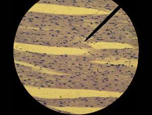 Кардиомиоциты в поле светового микроскопа (фото Kimberly Jennery).