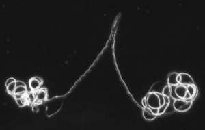 Сдвоенный сперматозоид жука Thermonectus marmoratus (здесь и ниже фото авторов исследования). Фото: http://science.compulenta.ru/upload/iblock/778/paired-sperm-120206.png