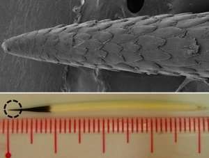 Крошечные зубцы (сверху) на кончиках игл дикобразов Северной Америки (внизу) легко проникают в плоть и трудно извлекаются. Фото: Woo Kyung Cho