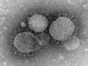 По решению ВОЗ новый коронавирус теперь называют &quot;синдром респираторного коронавируса Ближнего Востока&quot; (&quot;Middle East Respiratory Syndrome Coronavirus&quot;, или MERS). Фото: http://www.cdc.gov