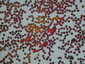 Окрашенная пыльца ромашки под микроскопом. Плодородна пыльца или нет - можно увидеть под микроскопом. (Фото: Bettina F&amp;#228;hnrich/Vetmeduni Vienna)
