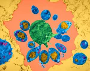 Малярийные плазмодии, разрушившие эритроцит (фото Dennis Kunkel Microscopy, Inc.).