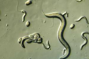 Нематода C. elegans с яйцами и детёнышами (фото Carolina Biological).