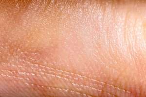 Человеческая кожа, выращенная в лаборатории, может заменить кожу животных ©depositphotos.com/deyangeorgiev2