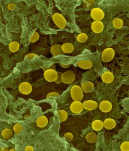 Почвенные бактерии Acidobacterium. (Фото Dennis Kunkel Microscopy, Inc. / Visuals Unlimited / Corbis.)