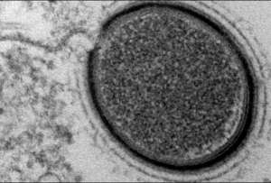  Обнаруженный учеными Mollivirus Sibericum – четвертый по счету доисторический вирус, обнаруженный с 2003 года ©siberiantimes.com