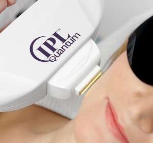Фотоомоложение — один из наиболее эффективных методов аппаратного воздействия на кожу лица, шеи и тела.
