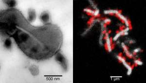 Слева продемонстрирована прочная связь паразитирующих бактерий TM7x со своим хозяином Actinomyces odontolyticus. Справа красным цветом отмечены TM7x на его поверхности. Фото UCLA.