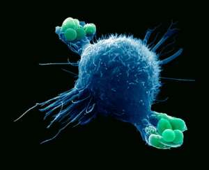 Иммунный макрофаг, поедающий бактерий. (Фото Dr. David Phillips / Visuals Unlimited / Corbis.)